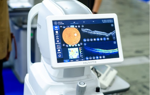 A view of what appears on the screen and what is measured on a OCT scan