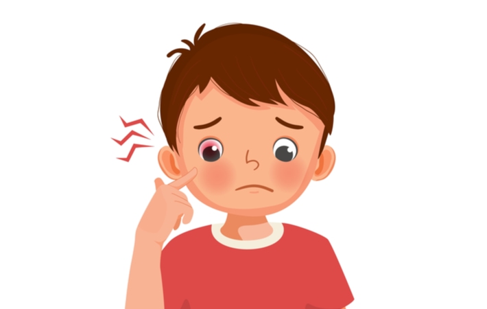 A cartoon rendition of a young boy pointing to his sore, itchy, pink eye or viral conjunctivitis