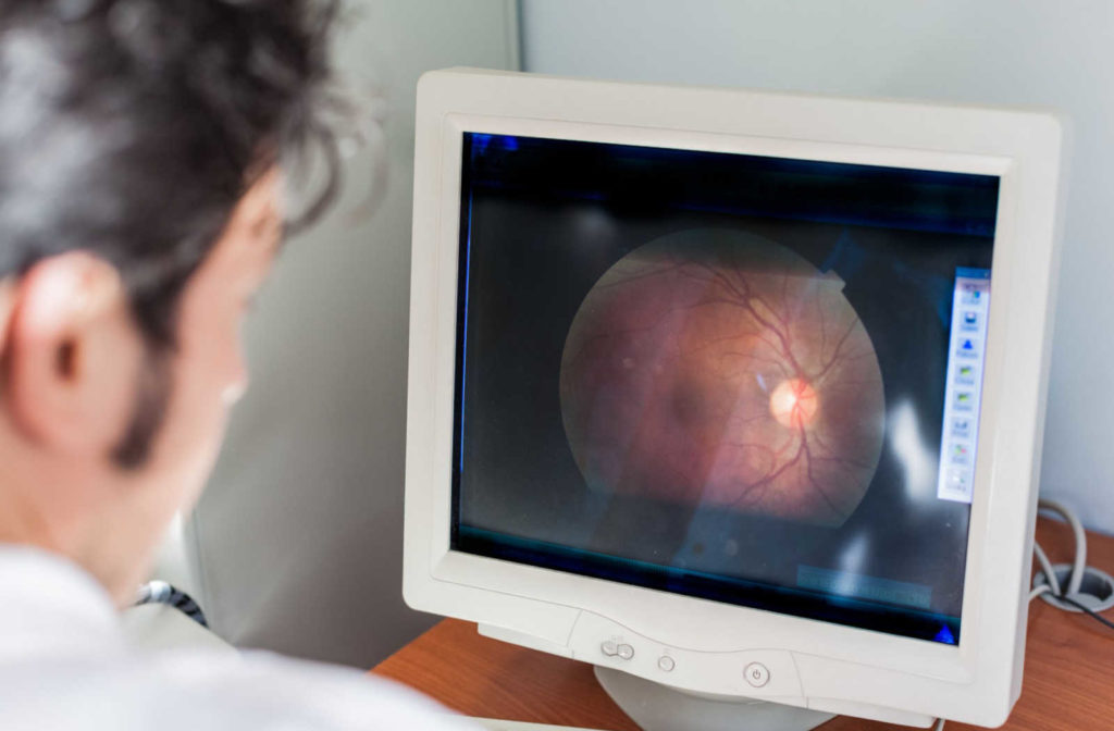 An eye doctor looks at retinal imaging on a computer screen.