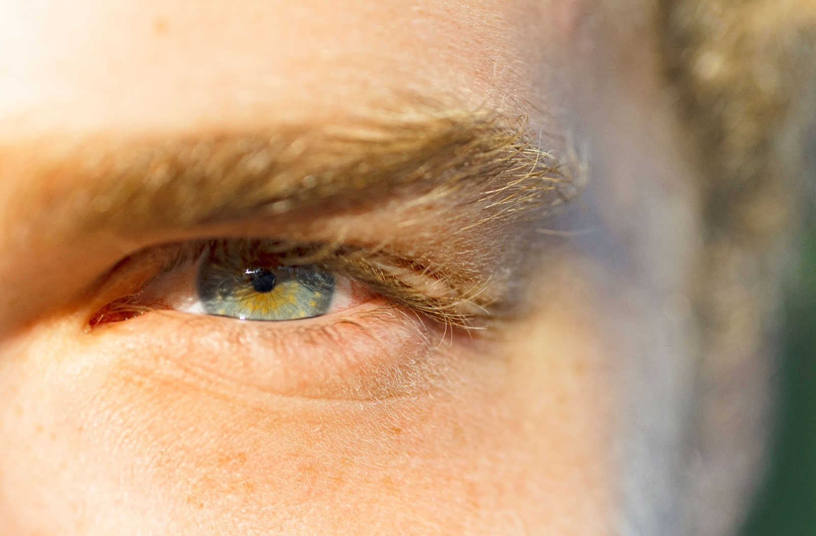 Are Blue Eyes More Sensitive to the Sun?