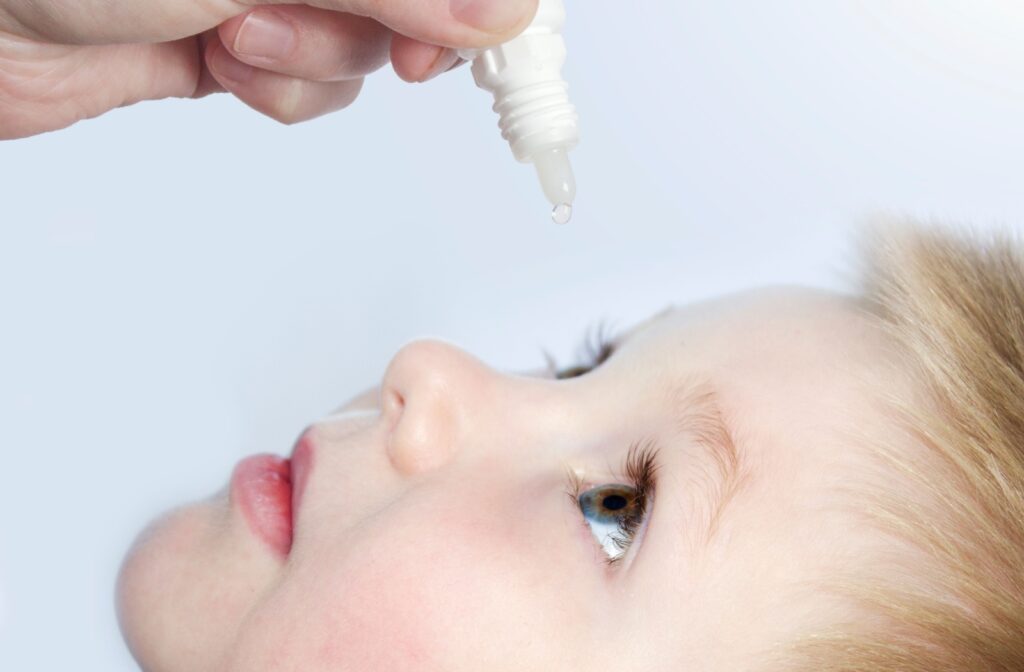 A close-up of a young child looking up toward eye drops about to drop into his eye.