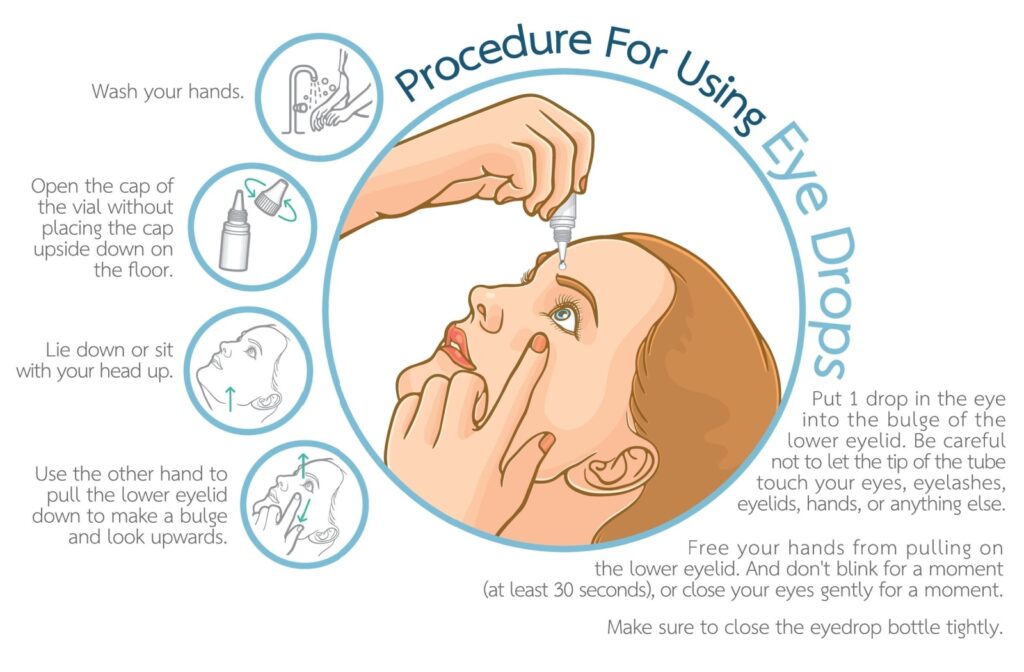 Infographic: Procedure for using eye drops