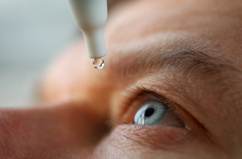 A close-up photo of someone administering an eye drop into their eye.