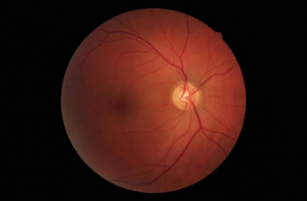 A digital image of a retina taken at the eye doctors